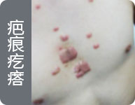 西安疤愈瘢痕诊疗中心