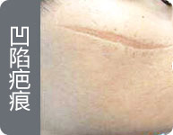 西安疤愈瘢痕诊疗中心