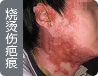 西安疤愈瘢痕诊疗中心