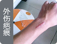 西安疤愈瘢痕诊疗中心