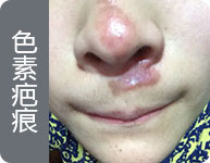 西安疤愈瘢痕诊疗中心